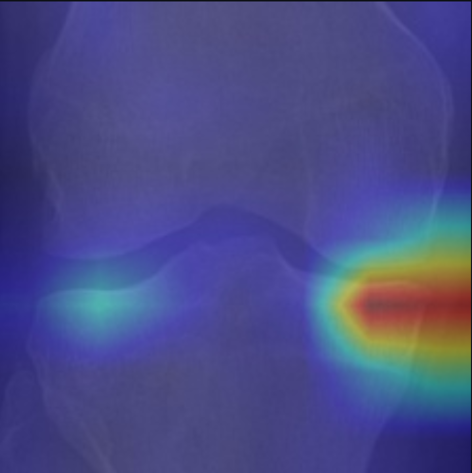 Grad-CAM heatmap