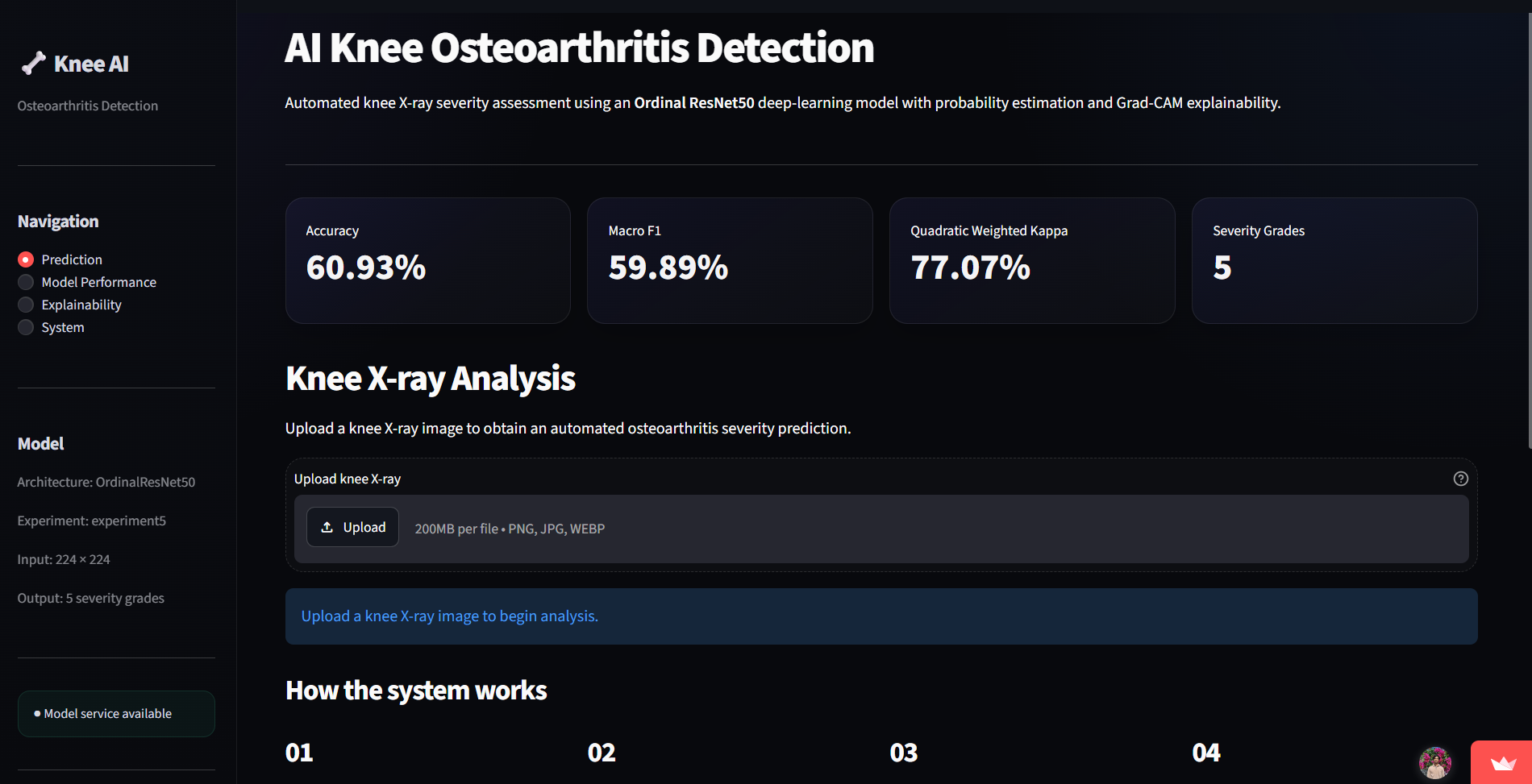 AI Knee Osteoarthritis Detection application